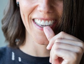 a woman smiling while wearing her Invisalign trays