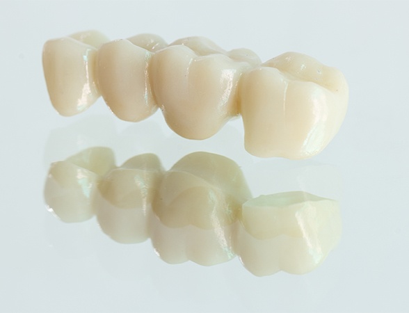 Ceramic dental crowns prior to placement