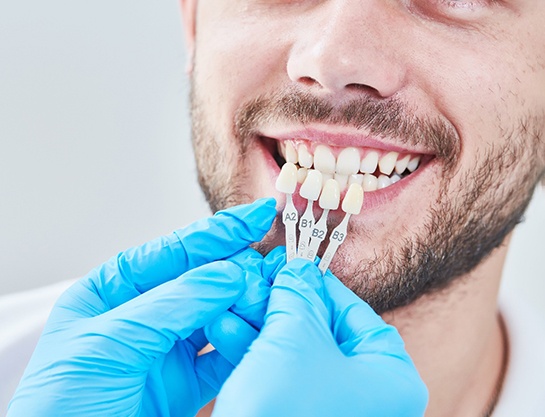 a cosmetic dentist holding up a shade chart to someone’s smile