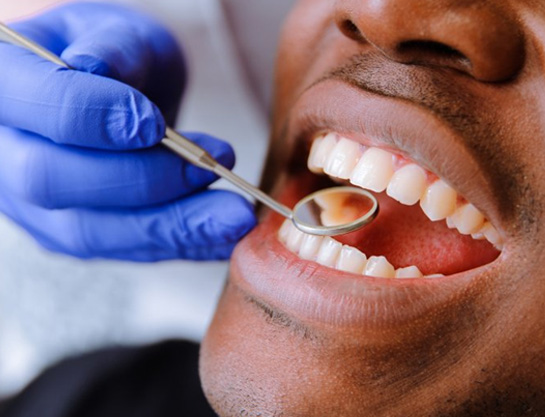 a dental patient showing dental discoloration