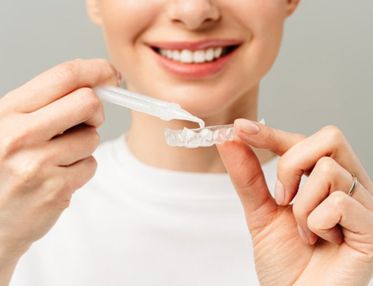 a person preparing to wear their at-home teeth whitening tray